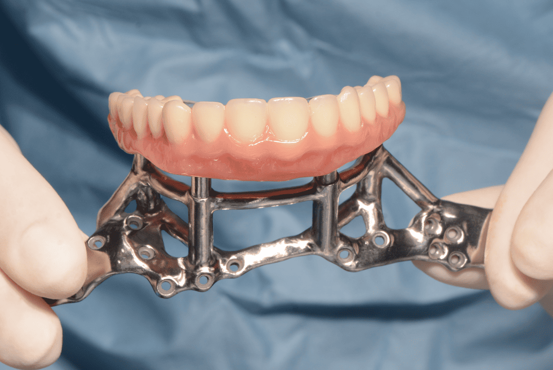 Estructura de soporte protésico