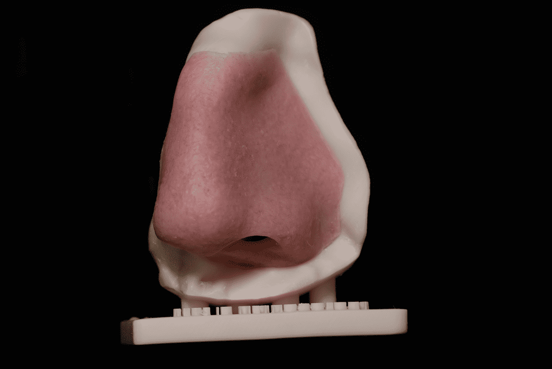 Prótesis nasal personalizada